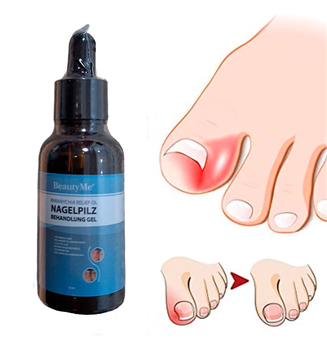 Miniatura 5 de ACEITE REPARADOR DE UÑAS